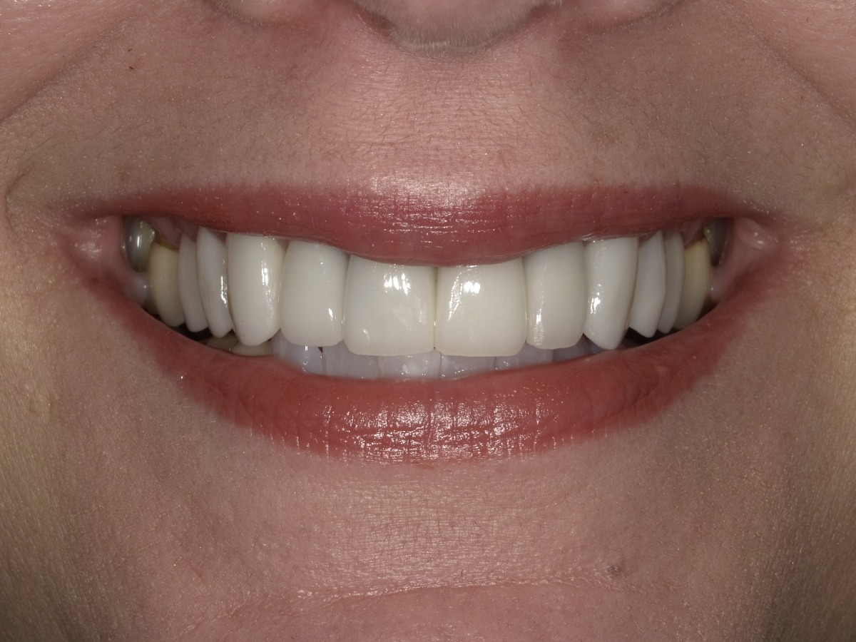 After Image
