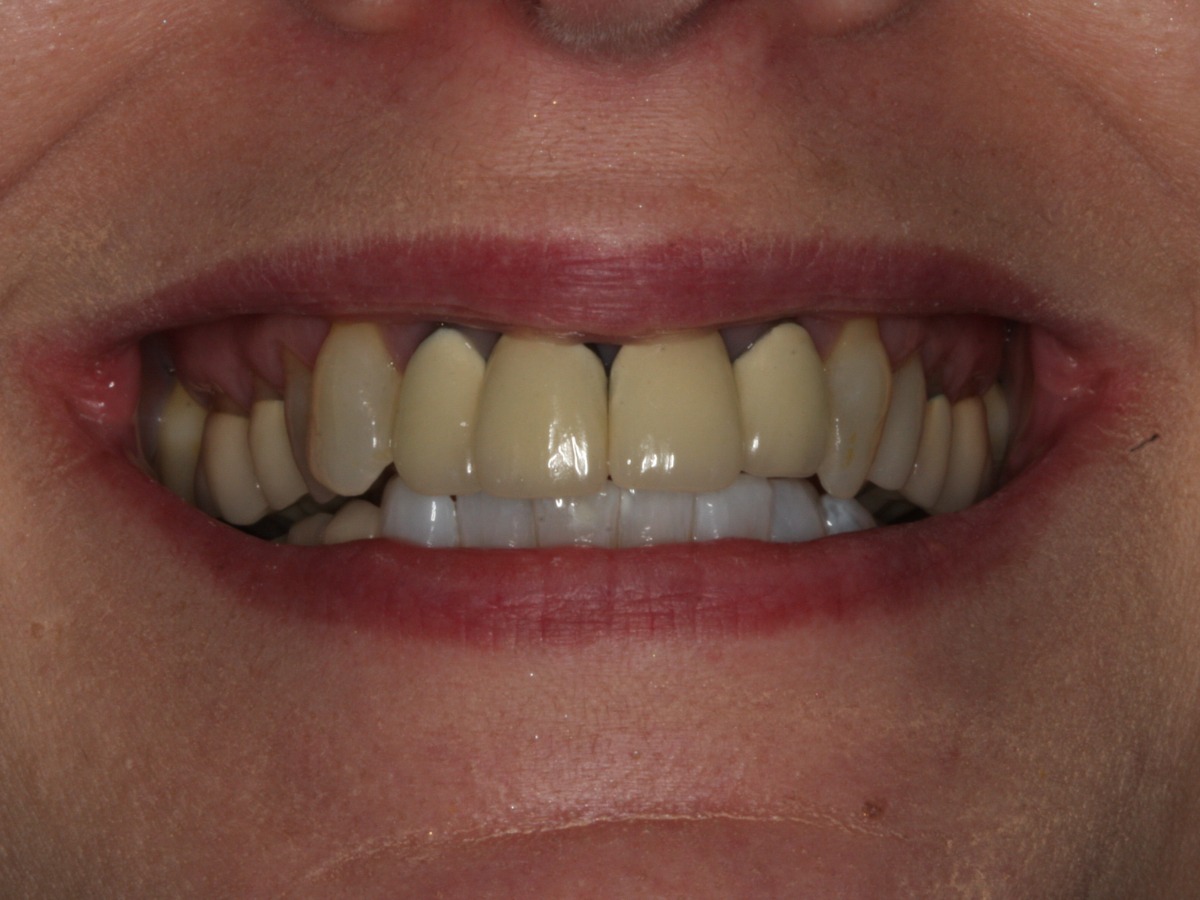 Before Image