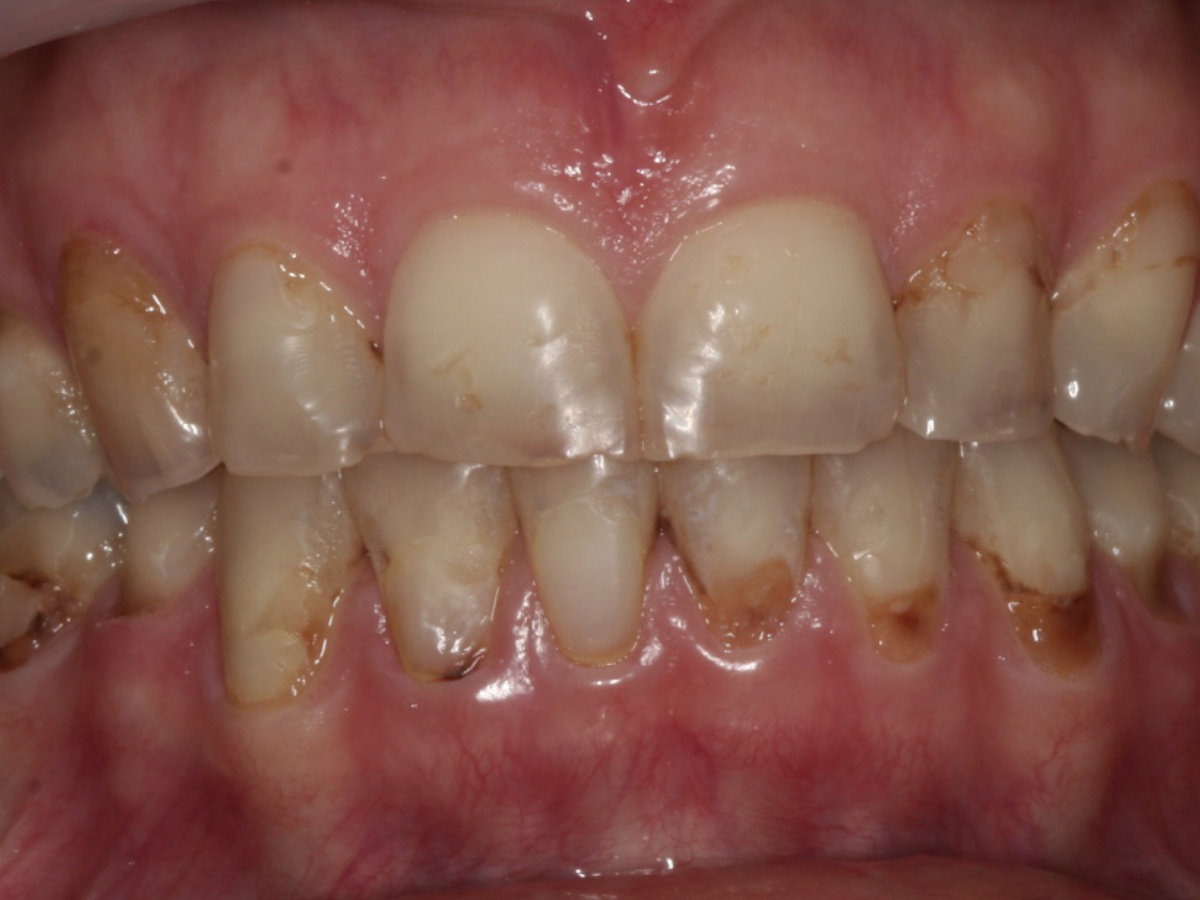Before Image