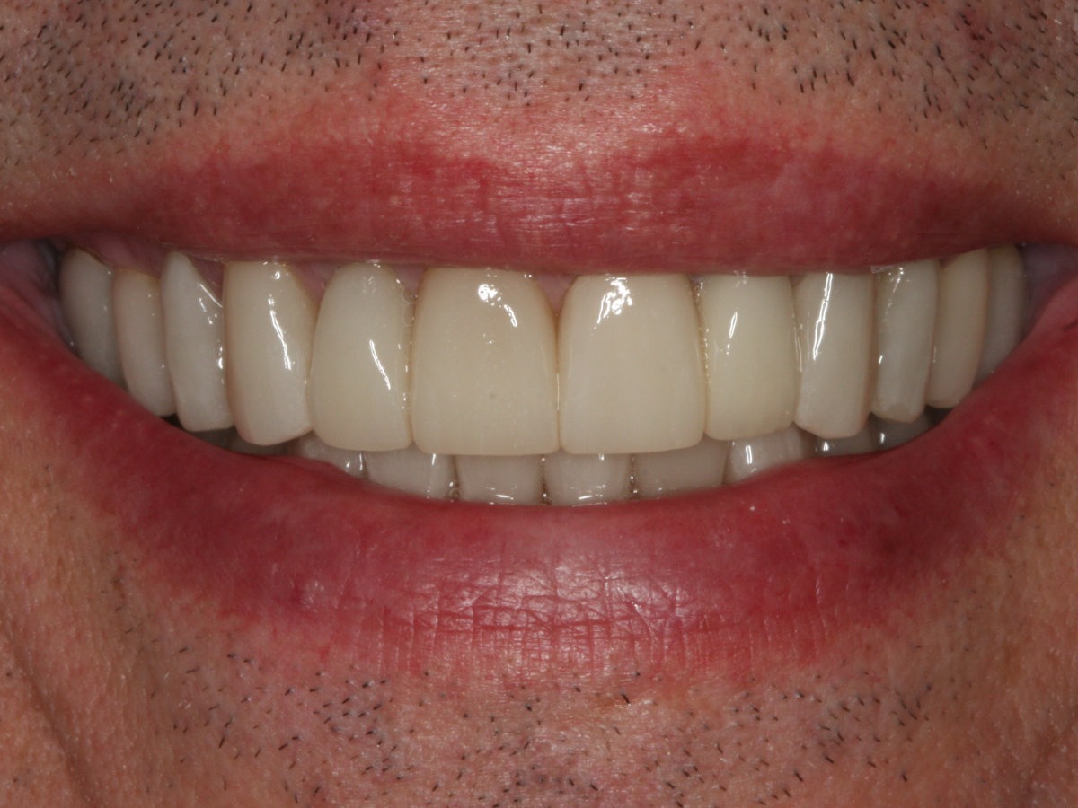 After Image