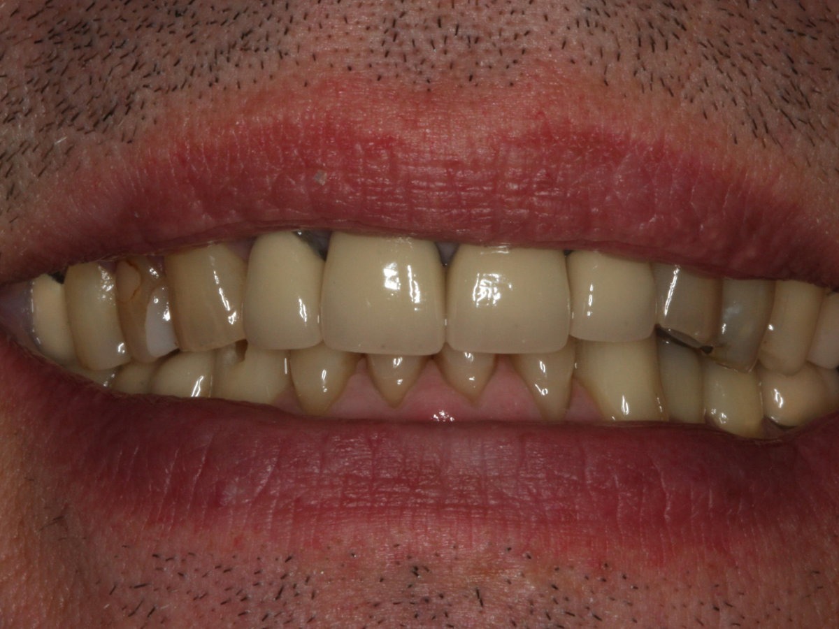 Before Image