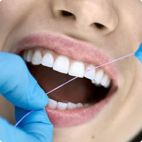 Preventative Cleanings