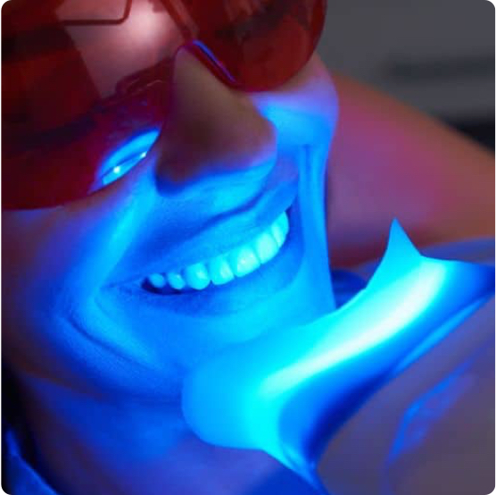 Teeth Whitening