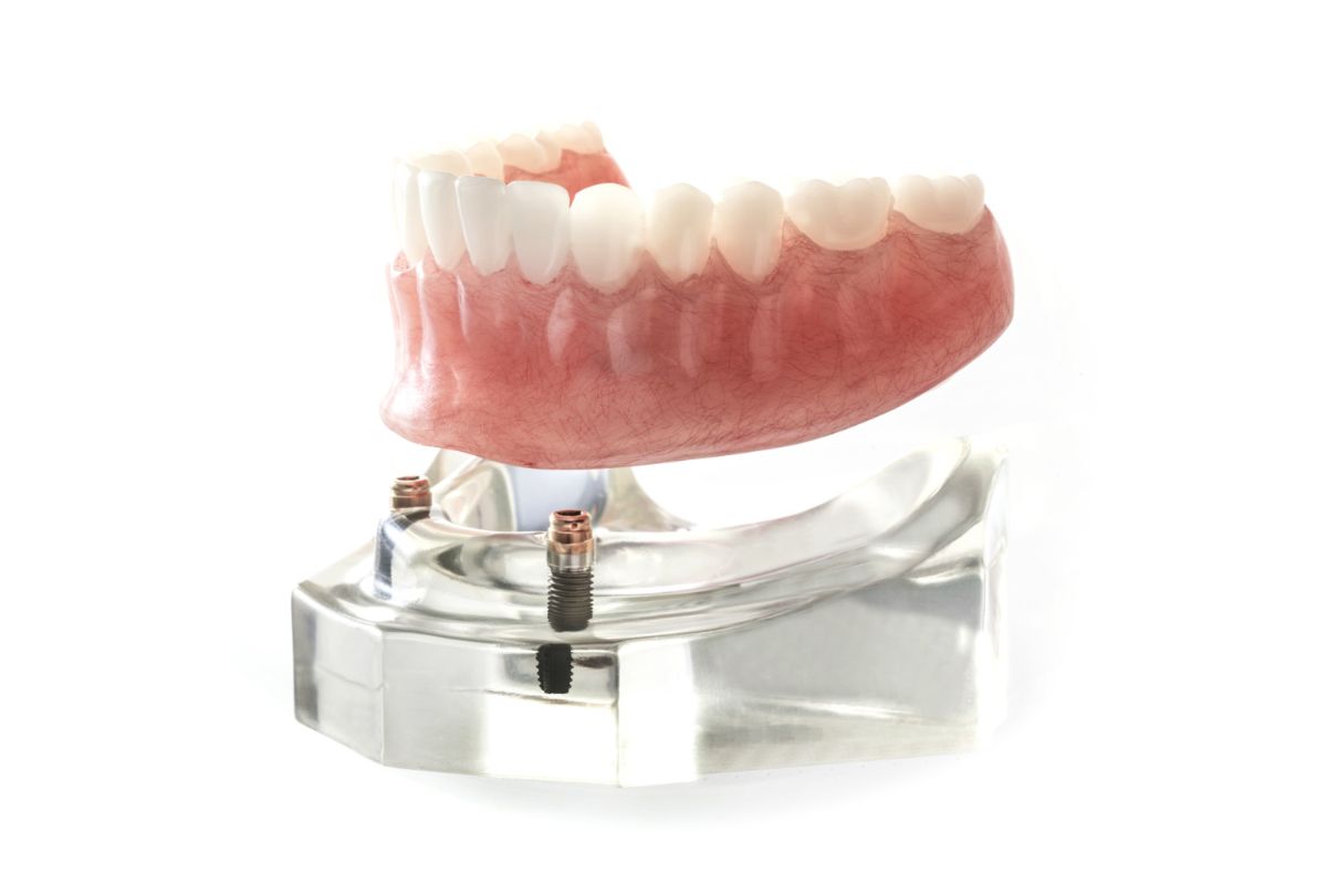 Pull Your Tooth or Save It - Which is Best?