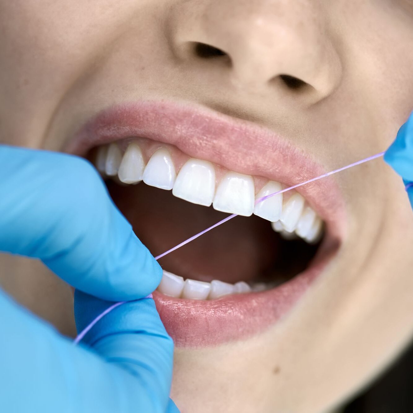 AdobeStock_298745998 Floss